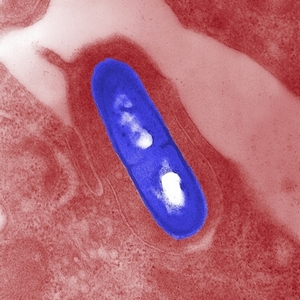 listeria monocytogenes electron micrograph 